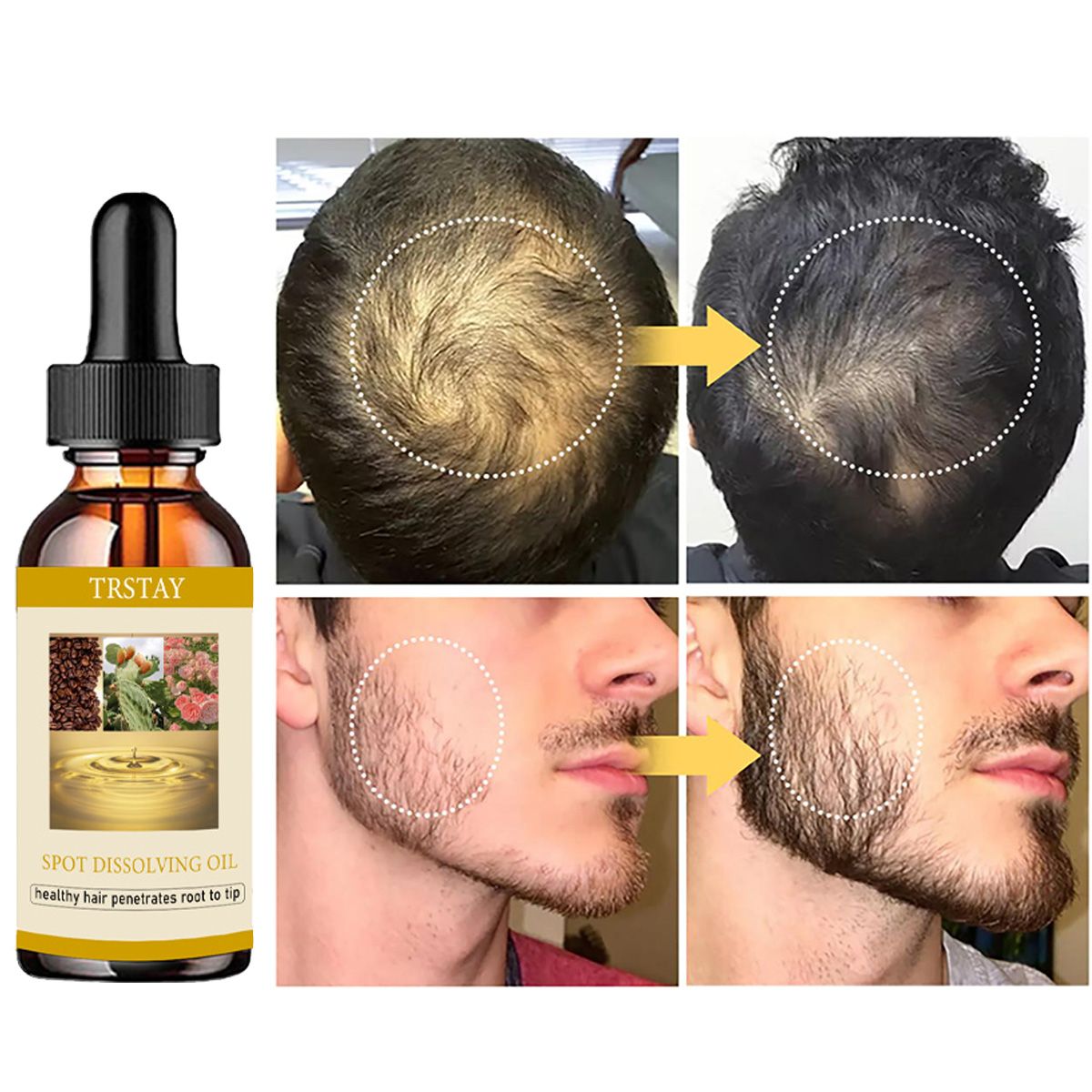 50ml óleo de crescimento de ba - Home Barber avaliação e preço